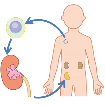 iPS細胞を用いた腎臓の再生研究の現在（総論）