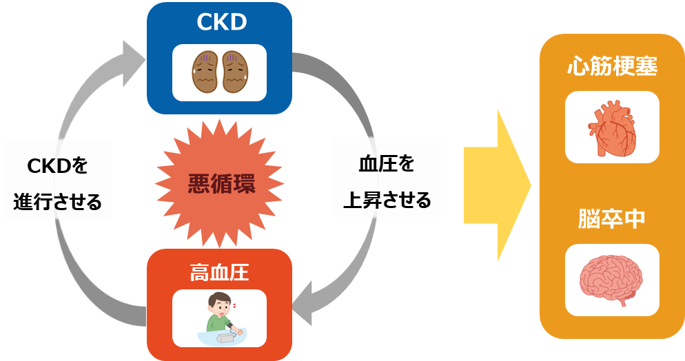 CKDと高血圧の関係