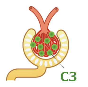 C3腎症